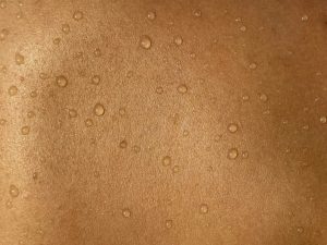 Ontdek de voordelen van laser behandelingen voor een stralende huid